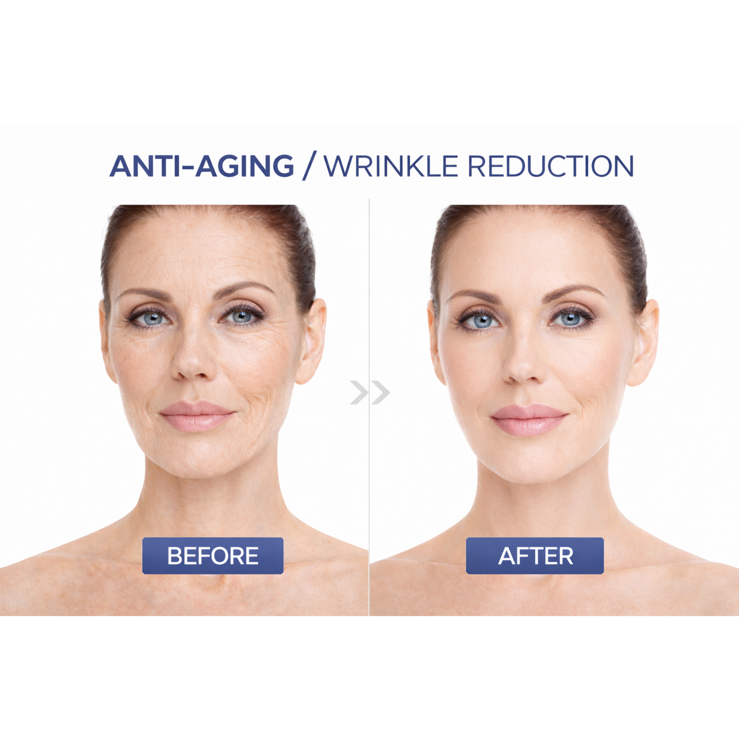 Anti-Wrinkle Face Sculpting EMS Tool