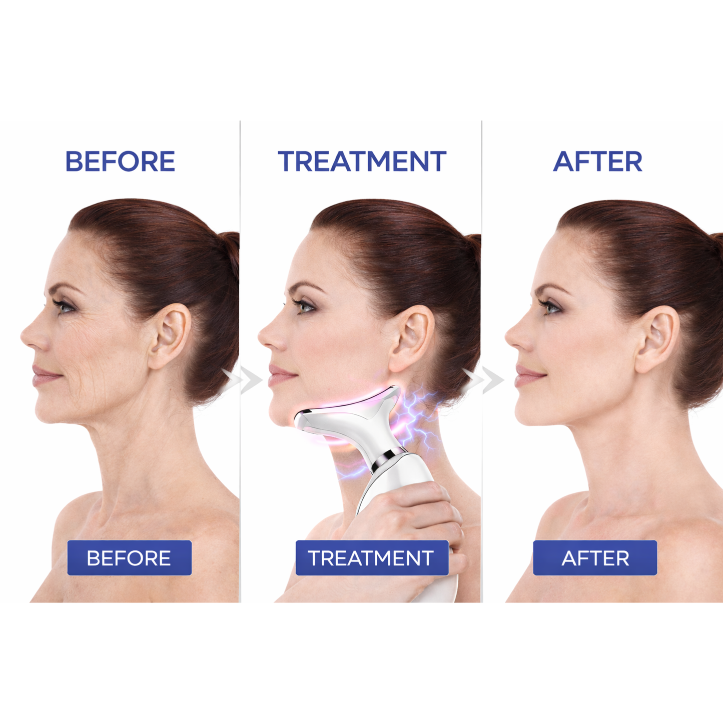 Anti-Wrinkle Face Sculpting EMS Tool