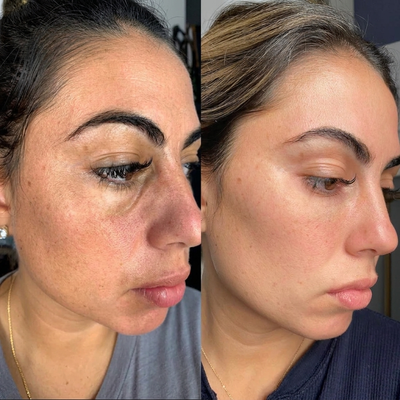 Customer photo